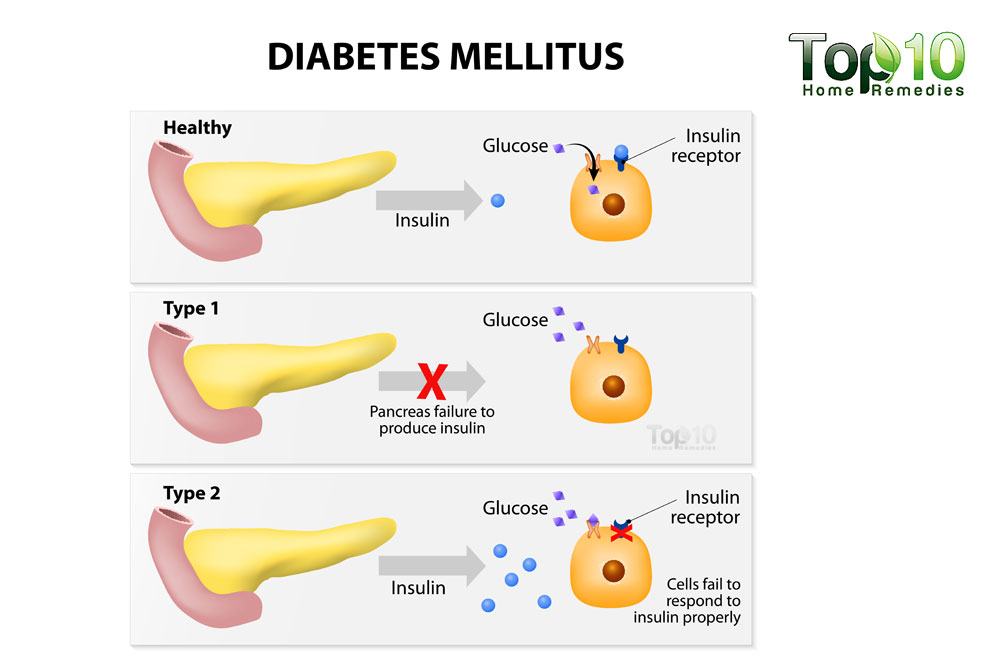 Zverev Diabetes